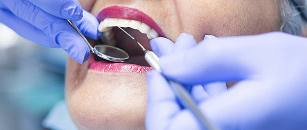 Best Broken or Chipped Tooth Repair in Feasterville, PA